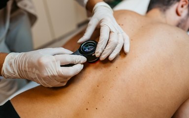 Prevenzione: Melanoma day, a breve istituita la Giornata nazionale