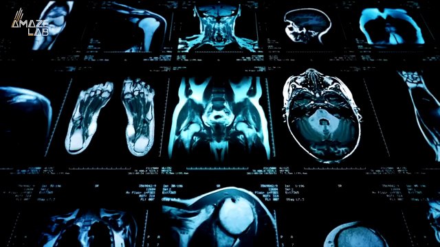 Looking at the Brain and the Heart at the Same Time? This New Tech Does Just That