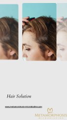 Smp Near Vancouver WA – The Art of Hair Restoration, Made Effortless!