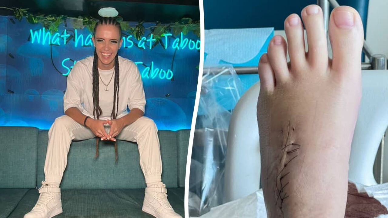 Woman suffered seizures for five years due to a wooden splinter lodged in her foot