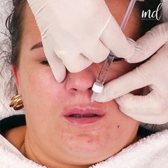 Pout perfection in progress! 💋