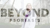 Beyond: Psoriasis