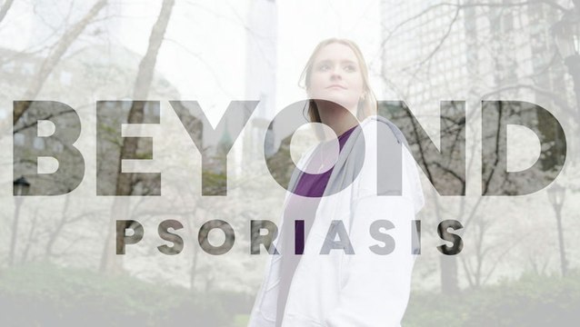 Beyond: Psoriasis