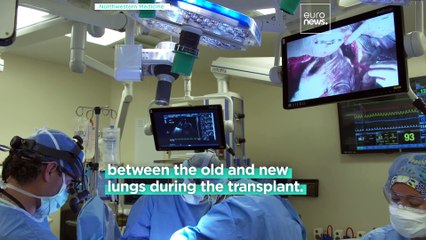 German woman has no signs of cancer after undergoing a new double-lung transplant surgery