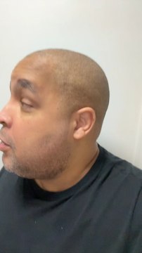 Je vis avec le diabète, comme 4,5 millions de Français 🇫🇷 #diabete #diabetique #obesite