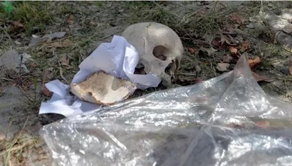 Şaşırtıcı Keşif: Çöpten Kağıda Sarılı İnsan Kafatası Çıktı 🧠