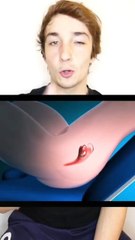 Insérer et retirer un stérilet