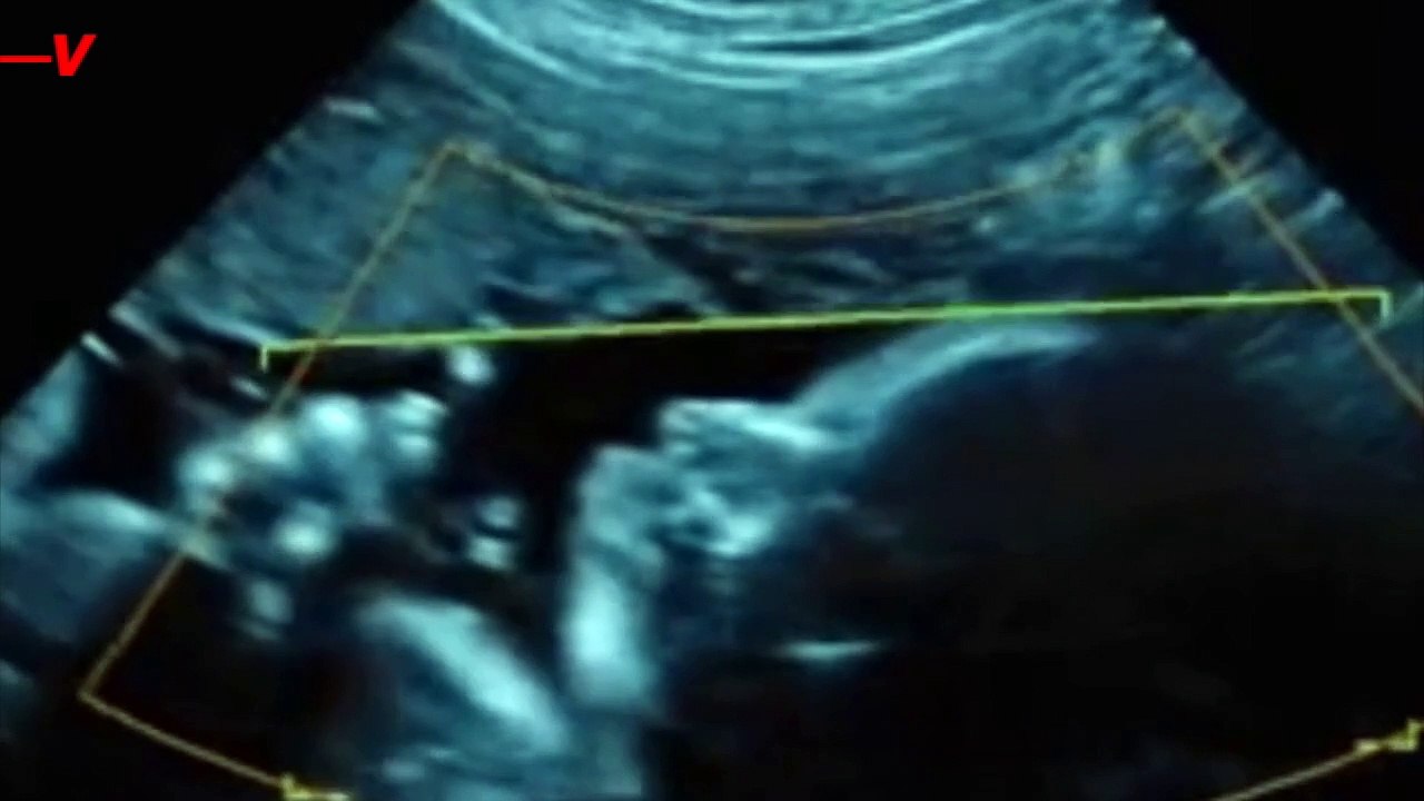 Have You Ever Heard of Baby Name Mourning? Apparently, It’s a Real Thing