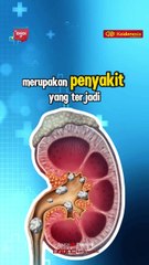 Risiko Batu Ginjal yang Ternyata Bisa Dideteksi dari Warna Urine!