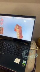 What do you need to know about invisalign virtual treatment planning.