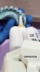 Temporization offers patients to try out the look and feel of the final prosthesis and make any necessary changes before the final fabrication and fitting.