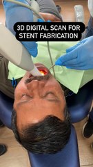 3D digital scan for Stent Fabrication for Dental Implant.