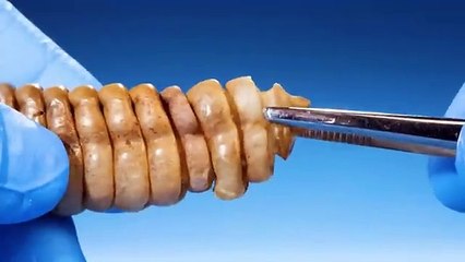 What's Inside a Rattlesnake Rattle?