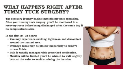 Understanding the Recovery Process After Tummy Tuck Surgery