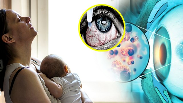 Postpartum Dry Eyes: डिलीवरी के बाद पोस्टपार्टम ड्राई आइस क्या होता है,Treatment, Symptoms,Causes.