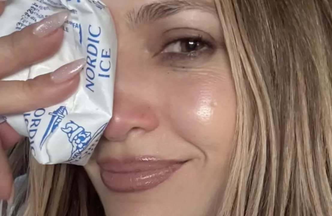 Jennifer Lopez experiences a facial injury during rehearsals