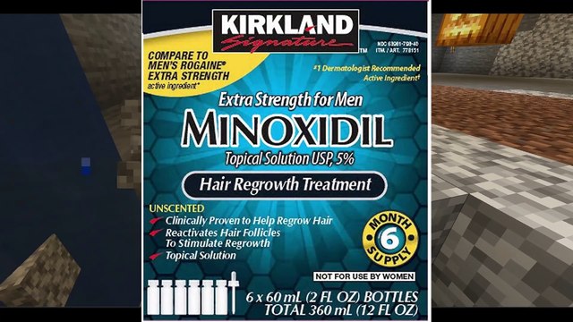 My Hair LOSS & REGROWTH Story While I Play MINECRAFT - Minoxidil (Rogaine) Finasteride & Dermaroller