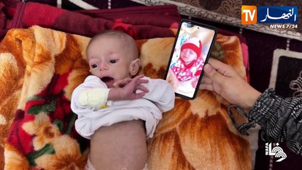 فلسطين: سوء التغذية والحصار الخانق يزيد معاناة الأطفال الرضع في قطاع غزة