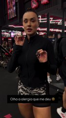 Influenciadora mostra manchas no corpo após reação alérgica e preocupa fãs; saiba quem