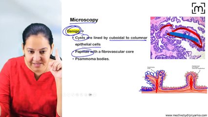 20.08 Ovarian Tumours