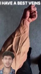 Most Insane Veins in the World ....#shorts #veins #viralvideo