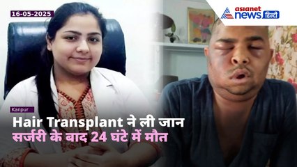 Hair Transplant बना जानलेवा! Kanpur में एक और इंजीनियर की मौत | Shocking Reality