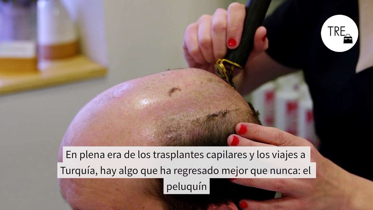 En plena era de los trasplantes capilares y los viajes a Turquía, hay algo que ha regresado mejor que nunca: el peluquín
