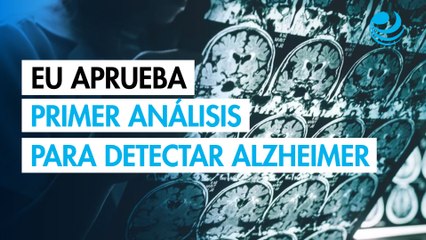 EU aprueba uso inédito del primer análisis de sangre para detectar Alzheimer