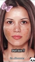 How to get clear skin with these simple Tips 🤯#clearskin #kpop #blackpink