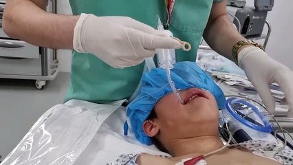 Eye surgery under general anesthesia, remove congenital cataract #IOL