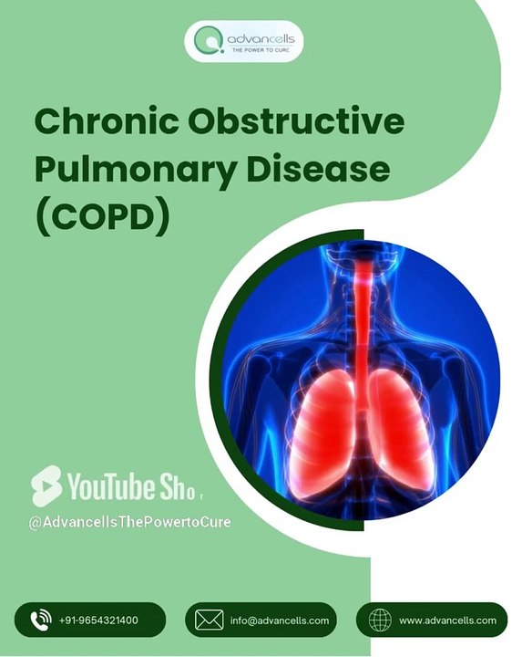 Breathe Easy: Understanding #COPD, #StemCellTherapy & #LungHealth