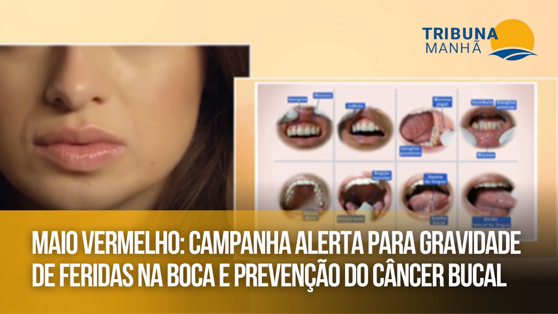 Grátis: Alterações de tecidos moles - Material Claro e Objetivo em PDF para  Estudo Rápido, image size:1920x1080