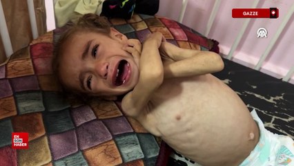 Gazze'de çocuklar yaşam mücadelesi veriyor