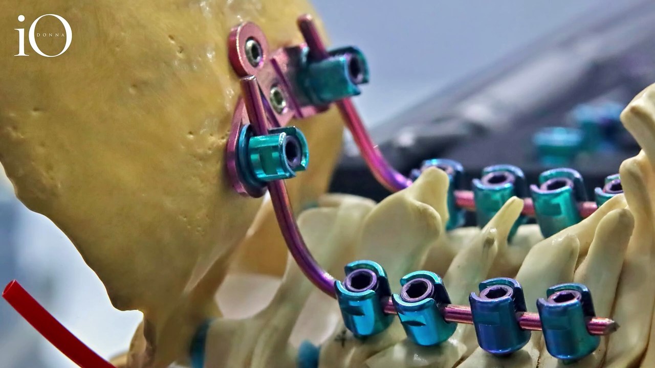 Eugenia di York e l'intervento per la scoliosi: «Non riuscivo ad alzarmi dal letto»