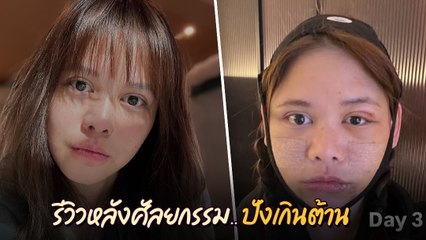 พิมพ์ พิมพ์มาดา หลังศัลยกรรม ในวัย 45 ปี เป๊ะปังเว่อร์