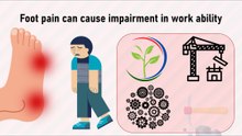 Foot pain can cause impairment in work ability