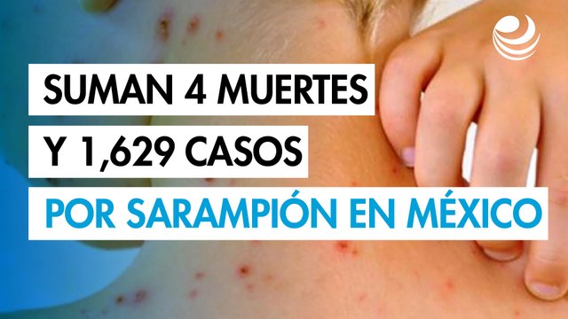 Sarampión en México: Suman 4 muertes y 1,629 casos confirmados