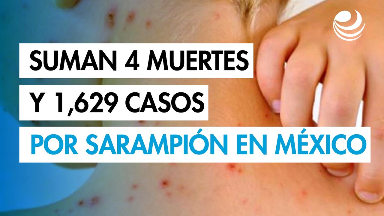 Sarampión en México: Suman 4 muertes y 1,629 casos confirmados