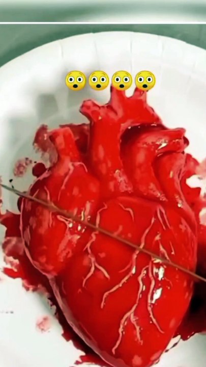 Asrm cake videos