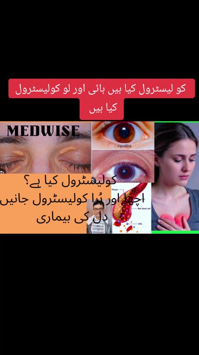 کولیسٹرول کیا ہیں