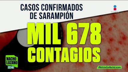 Chihuahua vive una crisis por el brote de sarampión