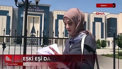 Eski eşi tarafından darbedilen Sena: Kadın cinayeti olarak anılmak istemiyorum