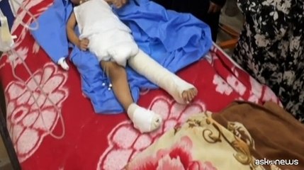 Il calvario di un orfano palestinese, ferito grave senza cibo e cure
