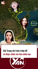 Gái Trung chi trăm triệu để có má lúm đồng tiền