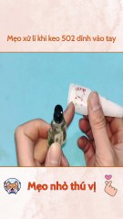 Mẹo xử lí khi keo 502 dính vào tay