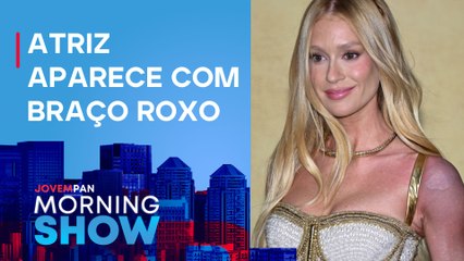 Você viu o HEMATOMA de Marina Ruy Barbosa em CANNES? VEJA o que CAUSOU!