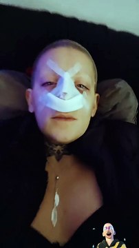 El cambio de look de Furia: se sometió a una cirugía estética y compartió el resultado