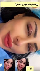 ريماس منصور بعد قص الجفون