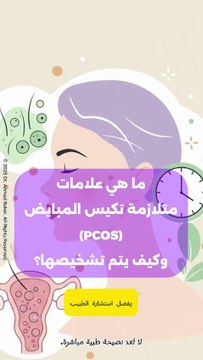 متلازمة تكيس المبايض : كل ما تحتاجين معرفته عن الأعراض والتشخيص
