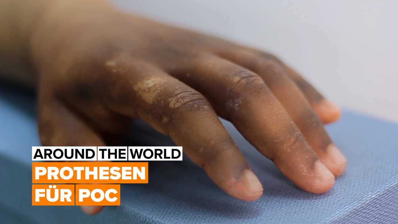 Prothesen für persons of colour